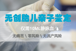 成都孕期亲子鉴定中心几天可以出结果